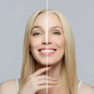 anti aging